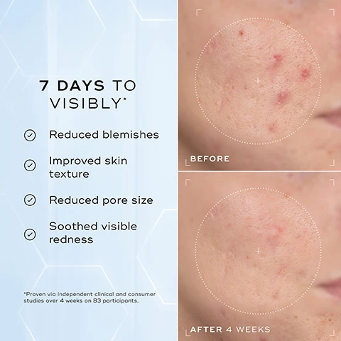 Image 1 - The image displays a before and after comparison of facial skin, showing a top image with several red blemishes labeled BEFORE and a bottom image of the same skin area with greatly reduced blemishes and redness labeled AFTER 4 WEEKS, alongside text that reads 7 DAYS TO VISIBLY*, Reduced blemishes, Improved skin texture, Reduced pore size, Soothed visible redness, and *Proven via independent clinical and consumer studies over 4 weeks on 83 participants. Image 2 - The image shows a woman with glowing skin applying a product to her face, next to text that reads Proven to deliver an instant, visible Glass-like Glow* *Proven via independent consumer study conducted over 4 weeks on 53 participants. Image 3 - A before and after image shows a persons cheek, with the left side labeled BEFORE displaying visible redness and blemishes, and the right side labeled AFTER 4 WEEKS showing significantly reduced redness and improved skin texture; below, text reads CLINICALLY PROVEN TO VISIBLY Reduce visible redness & improve skin barrier health* *Proven via independent consumer and clinical studies conducted over 4 weeks on 83 participants, next to a blue and white bottle of Medik8 Niacinamide Peptides. Image 4 - A light blue and white Medik8 pump bottle, labeled Niacinamide Peptides Balancing & Pore-Refining 10% Niacinamide Serum with Peptides & NAG, 30mLe / 1.0 FL Oz, is displayed alongside text detailing its key ingredients and benefits: 10% Niacinamide minimises the look of blemishes, pores & excess oil; 3% Crystalide™ Peptide renews skin radiance; N-Acetyl Glucosamine (NAG) supports the skin barrier; 1% Zinc PCA helps to visibly reduce excess sebum; and Hyaluronic Acid attracts water for plumped, smooth skin. Image 5 - An infographic titled How to Layer illustrates AM and PM skincare routines: The AM routine features a sun icon and AM, followed by Medik8 Gentle Cleanse for Cleanse, Medik8 Press & Glow for Tone, Medik8 Clarity Peptides for Target, and Medik8 Daily Radiance Vitamin C for Moisturise & SPF; The PM routine features a moon icon and PM, followed by Medik8 Purifying Foam for Cleanse, Medik8 C-Tetra Luxe for Target, Medik8 Crystal Retinal for Vitamin A, and Medik8 Total Moisture Daily Cream for Moisturise.