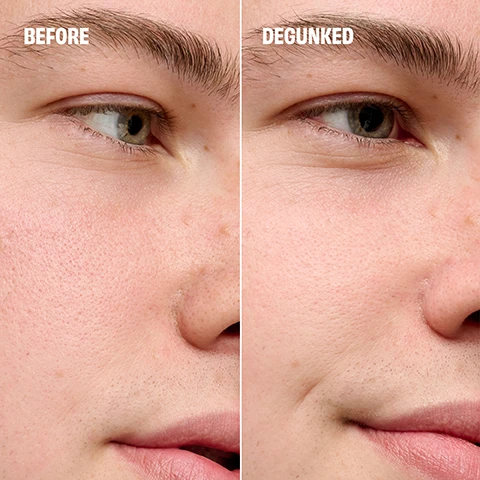 Image 4 - A close-up before and after comparison showing a persons skin on the nose and cheek, with the top section labeled BEFORE showing more visible pores and the bottom section labeled DEGUNKED showing smoother skin with less visible pores. Image 5 - A before and after comparison showing a persons chin and lower lip, with the top panel labeled BEFORE displaying skin with visible pores and some redness, and the bottom panel labeled DEGUNKED showing smoother skin with fewer visible pores. Image 6 - A product image features a purple tube with a metal extractor tip showing yellow residue labeled Pore Gunk, accompanied by text that reads Alkaline pH Formula helps loosen dead skin cells to prep pores for easy extraction. Detachable Extracting Tool twists off to dispense formula and reattaches to gently clear pores & cleanse blackheads. Image 7 - A close-up of a textured light mint green cream with a pink blob overlay on the left displaying the text: The POREfessional Degunker Visibly reduces blackheads & clogged pores instantly 96% said it easily extracts pore-clogging debris* 96% said skin looks clearer & smoother* *self-evaluation by 115 participants after 1 use. Image 8 - A four-panel image displays skincare ingredients and product textures: a teal cream swirl with text The POREfessional DEGUNKER, golden-brown plum seed oil with text PLUM SEED OIL helps skin feel soft, chopped oats with text BETA-GLUCAN extracted from oats helps hydrate & smooth skin, and white kaolin rocks with text KAOLIN helps purify, clean & unclog pores. Image 9 - A close-up of a light purple skin pore extractor tool with a metal tip showing visible residue and the word benefit, accompanied by the text EWW, OOH, AHH Visibly clearer pores and smoother skin after just one use, plus a super satisfying harvest! Image 10 - The image shows a four-step process for using a Benefit skincare product, with step 1 depicting a hand dispensing light green cream from a purple tube labeled The POREfessional onto a finger, step 2 showing a person with the light green mask applied to their nose and cheeks, step 3 illustrating a purple Benefit tool being glided across a nose, and step 4 featuring a close-up of the used Benefit tool, accompanied by the instructions: 1 Twist off extracting tool & apply formula to targeted areas on clean, damp face. 2 Wait 15-30 minutes, then rinse. 3 Reattach tool & gently glide across skin. 4 Rinse skin & tool. Image 12 - Close-up of a person applying a light blue-green mask to their nose and cheek with a hand that has pink nail polish. Image 3 - A split image of a persons face showing skin before and after treatment, with the left side displaying visible pores and the text BEFORE, and the right side showing smoother skin with reduced pores and the text DEGUNKED.