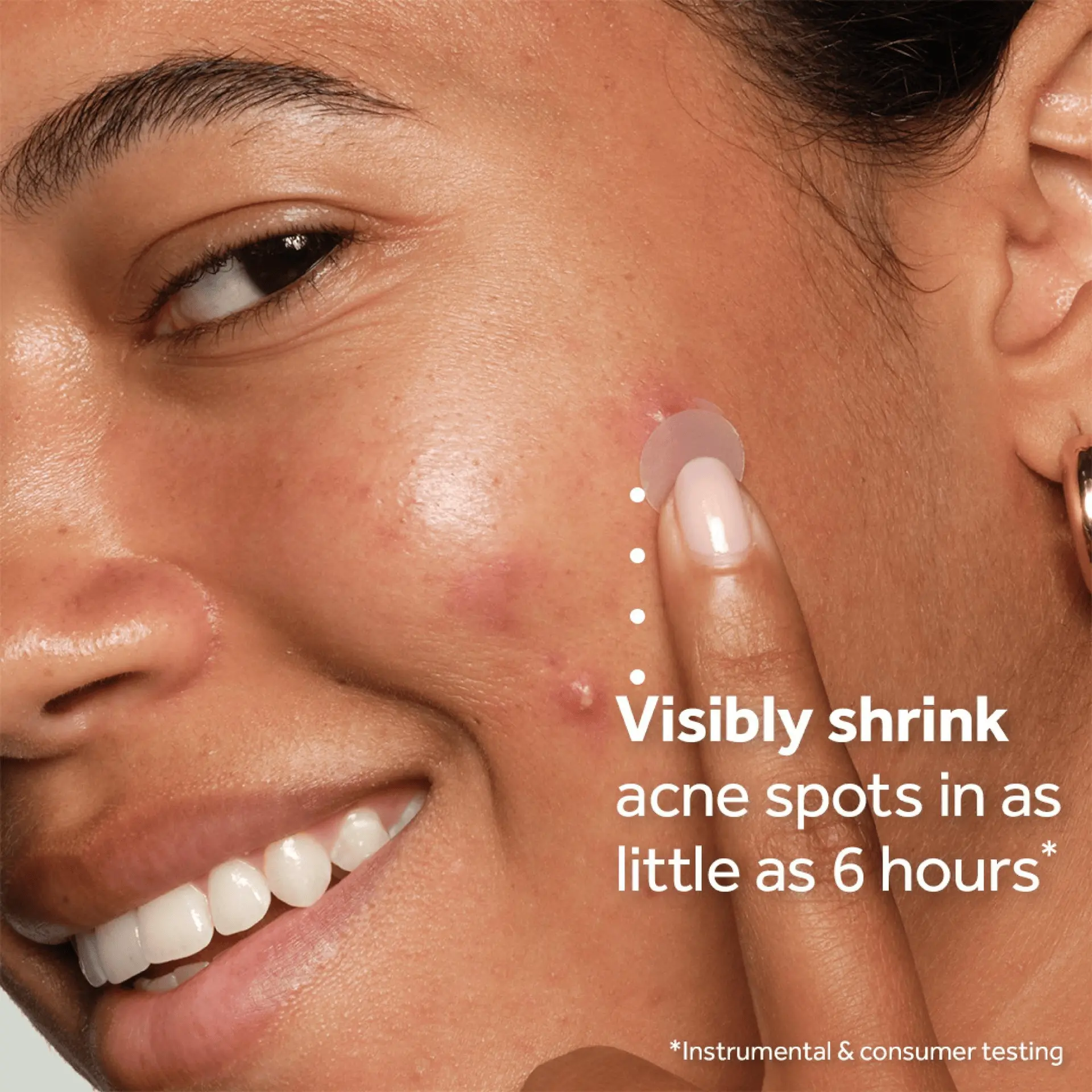 Woman applying clear acne patch to cheek breakout with text claiming visible shrinkage in 6 hours. No7 Derm Solutions Acne Patches box beside text stating 88% saw visibly reduced breakout spots. Hands peeling clear acne patches from sheet with instructions to apply to clean skin for 6 hours or overnight. Ingredient graphic showing 2% salicylic acid and hydrocolloid for acne treatment and skin healing.