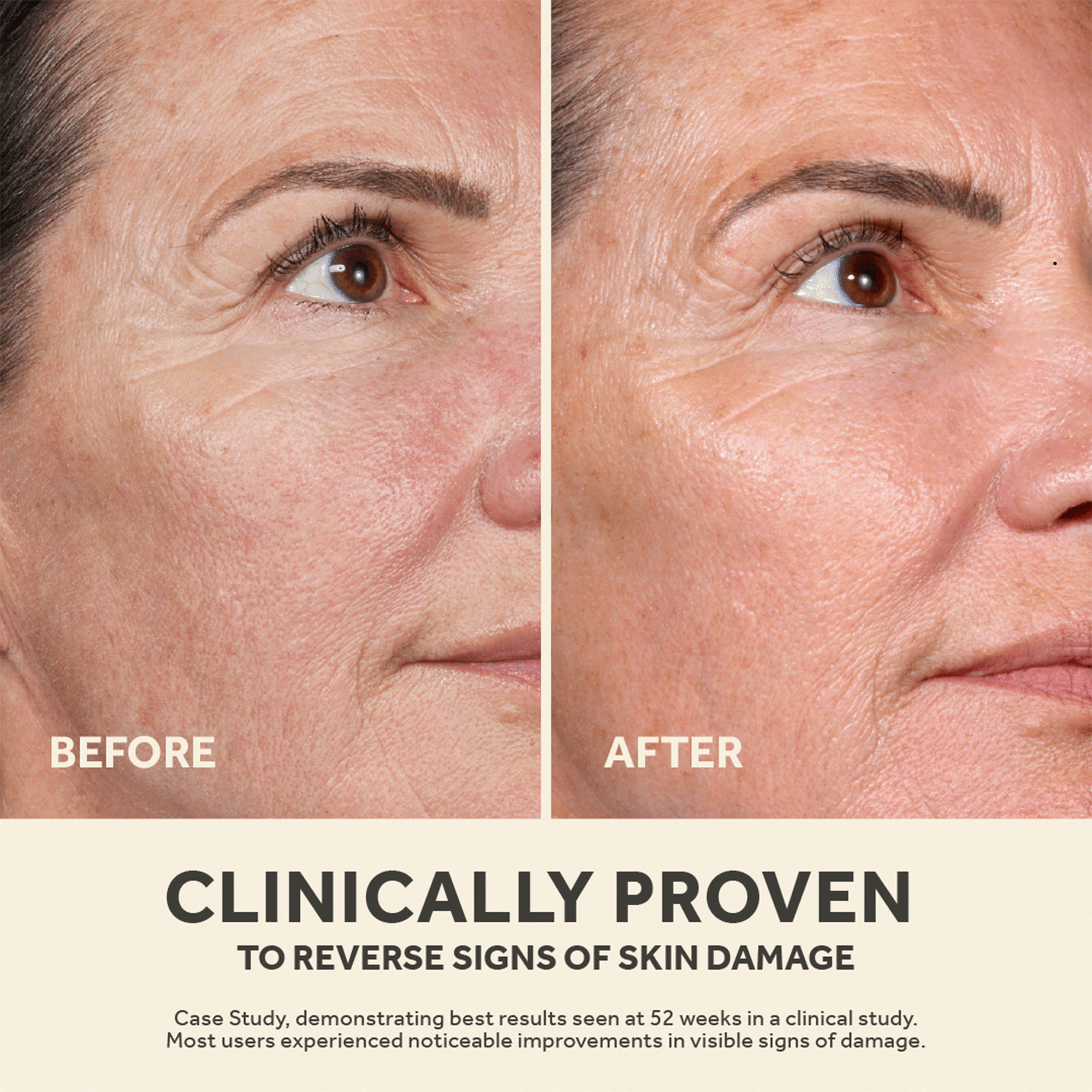Image 4 - Split face before and after photos showing skin improvement with text CLINICALLY PROVEN TO REVERSE SIGNS OF SKIN DAMAGE. Image 7 - Before and after skin care photos showing reduced facial wrinkles reading 100% clinically proven results.