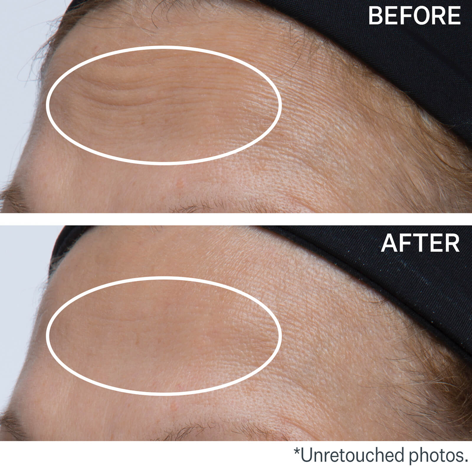 strivectin peptide serum