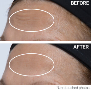 StriVectin Multi-Action Active Infusion Youth Serum