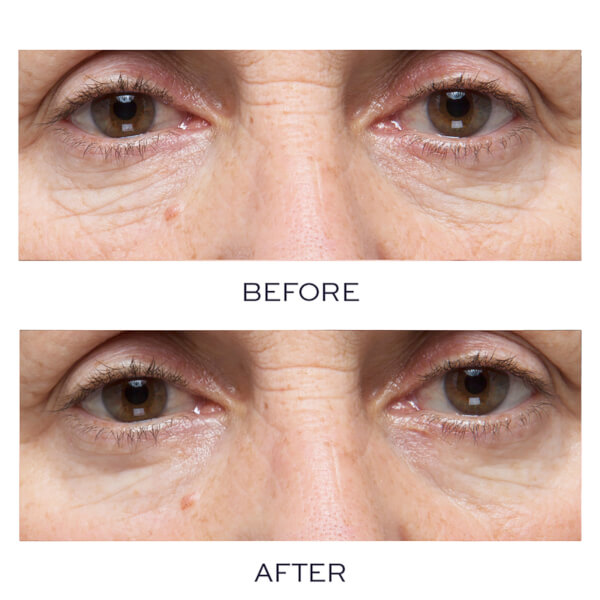 Elemis ProCollagen HydraGel Eye Mask (Pack of 6) Free Shipping