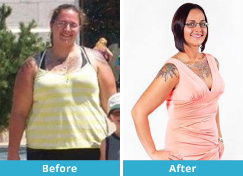 How Christine Got Her Ideal Shape How Christine Got Her Ideal Shape